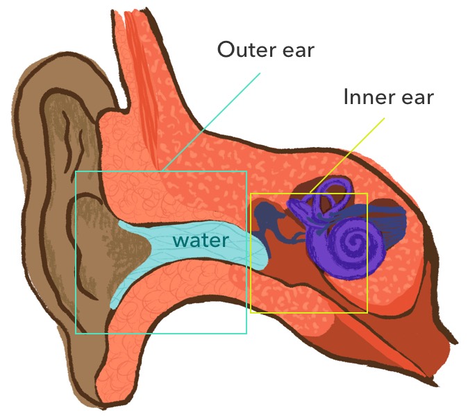 Four ways to tell swimmer’s ear from an ear infection - Allina Health