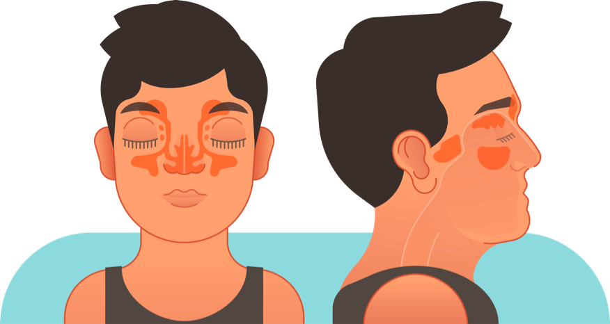 Facial illustration of sinus locations
